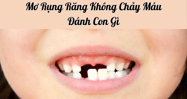 Chiêm bao thấy rụng răng không chảy máu đánh con gì?