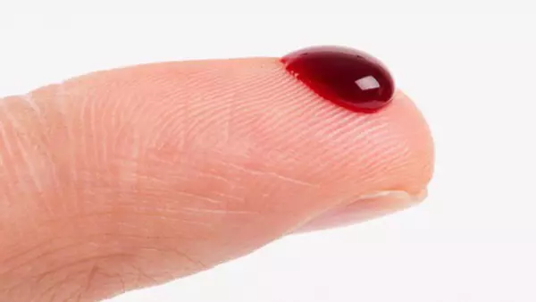Mơ thấy mình bị chảy máu là một điềm báo xấu